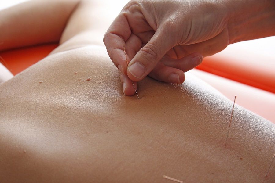 ¿Qué es la punción seca? 6 punción seca